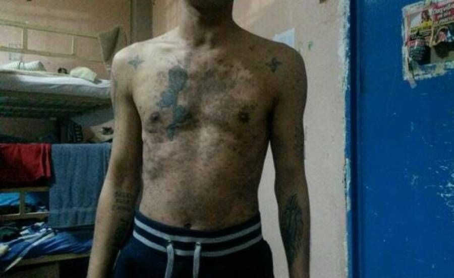 Νοσοκομείο Κορυδαλλού: εικόνες φρίκης από πάσχοντες