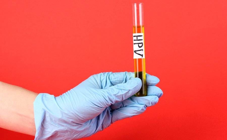 Κονδυλώματα: Ό,τι πρέπει να ξέρετε για τον HPV