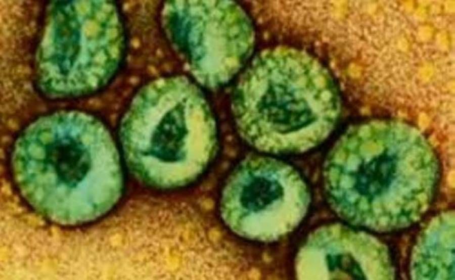 MERS: Στους 133 οι νεκροί στη Σαουδική Αραβία