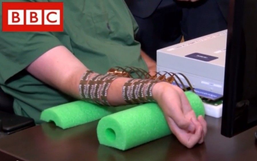 Τα παράλυτα άκρα θα κινούνται με τα δύναμη της σκέψης