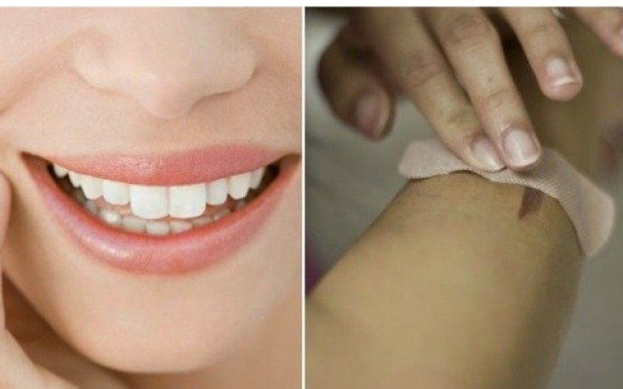 Οι άγνωστες χρήσεις του coconut oil στην ομορφιά και στην διατροφή
