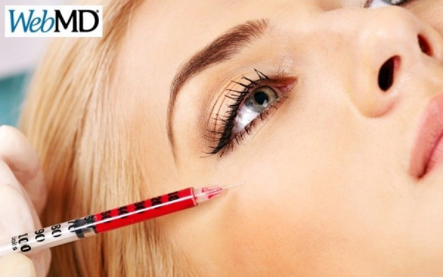 Όσα πρέπει να γνωρίζετε για το botox