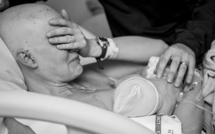 Οι viral φωτογραφίες της μητέρας που θηλάζει μετά από μαστεκτομή