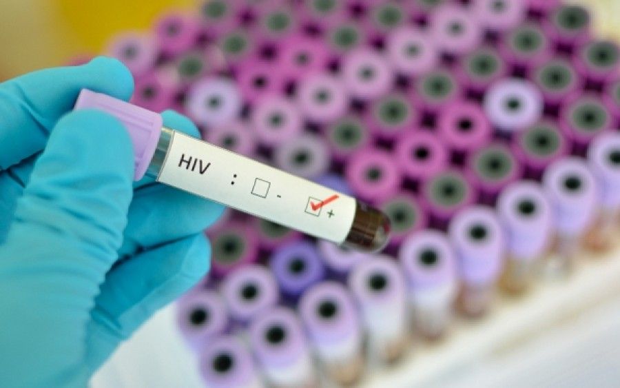 HIV: Εδώ και 12 χρόνια σε ύφεση ο ιός σε 18χρονη ασθενή παρά τη διακοπή της φαρμακευτικής αγωγής