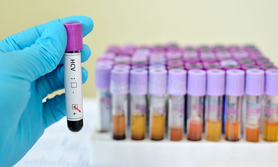 Ηπατίτιδα C: Άρση όλων των περιορισμών για τις θεραπείες - Οι χρήστες ουσιών το «κλειδί»