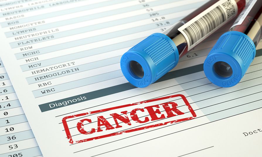 Λεμφοβλαστική λευχαιμία: Θεραπεία της Amgen αποτελεσματικότερη έναντι της χημειοθεραπείας