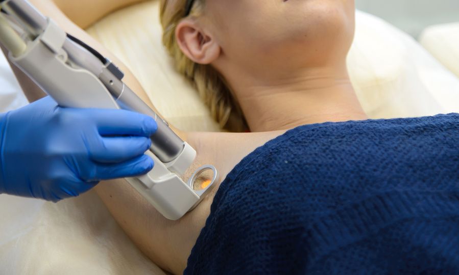 Υπ. Υγείας: Μόνο από ειδικευμένους δερματολόγους και πλαστικούς η αποτρίχωση με λέιζερ