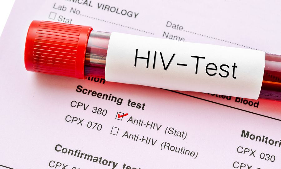 Σχέδιο δράσης για τον HIV: Συγκεκριμένο χρονοδιάγραμμα από το υπ. Υγείας ζητούν οι οροθετικοί