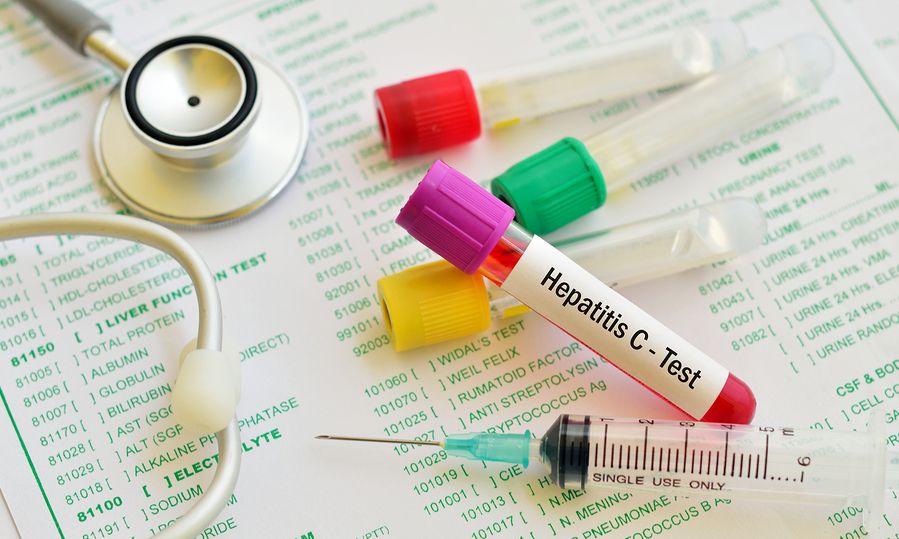 Ηπατίτιδα C: Στόχος η θεραπεία 86.500 Ελλήνων μέχρι το 2030 με καινοτόμες θεραπείες