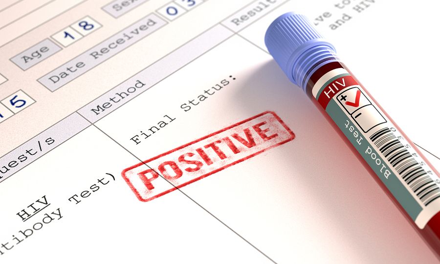 HIV: Αυξάνονται τα νέα περιστατικά στην Ευρώπη – Ανοδικές οι τάσεις και στην Ελλάδα