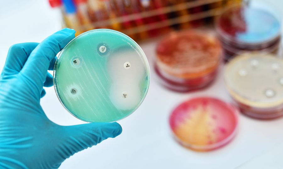 Στρεπτόκοκκος Β: Σχεδόν 150.000 μωρά πεθαίνουν ετησίως λόγω μόλυνσης της εγκύου