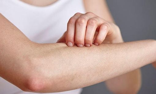 Υπάρχει αποτελεσματική θεραπεία για την ψωρίαση;