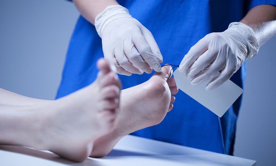 Τρεις γιατροί είπαν ότι είναι νεκρός, όμως αυτός ξύπνησε μέσα στο νεκροτομείο!