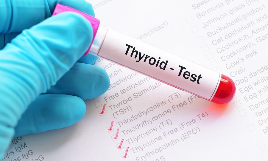 Θυρεοειδής: Οι φυσιολογικές τιμές TSH και T4 (πίνακας)
