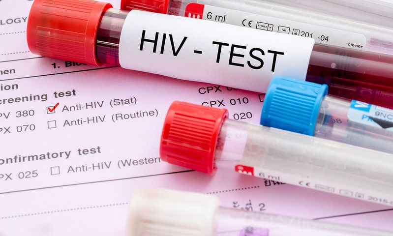 HIV Aids: Με προσδοκίες το νέο πρόγραμμα δωρεάν γρήγορης & ανώνυμης εξέτασης