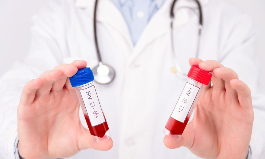 Χωρίς δύο βασικές εξετάσεις οι ασθενείς με hiv στην Ελλάδα