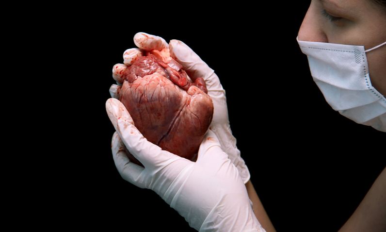 Η πρώτη μεταμόσχευση καρδιάς του 2019 έγινε σε ασθενή που περιμένε 3,5 χρόνια