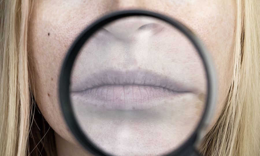 Ξηροστομία: Οι βασικές αιτίες σε εικόνες