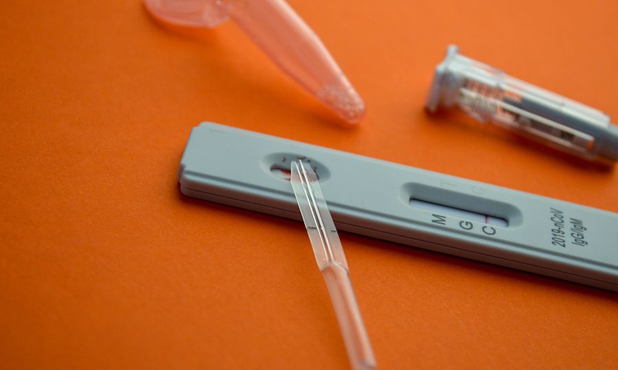 Τα νέα διαγνωστικά τεστ για την COVID-19 στρέφονται πλέον στην ανάλυση των ειδικών Τ λεμφοκυττάρων