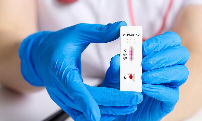 Σημεία δωρεάν ελέγχου Covid-19 από τον ΕΟΔΥ σήμερα Παρασκευή 13/8