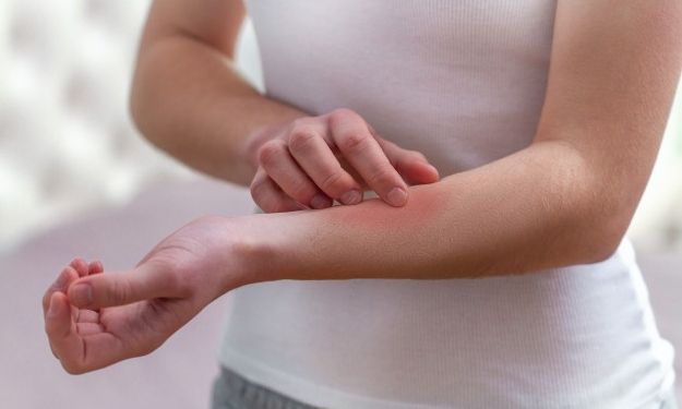 Οι μισοί Ευρωπαίοι έχουν τουλάχιστον ένα δερματολογικό πρόβλημα
