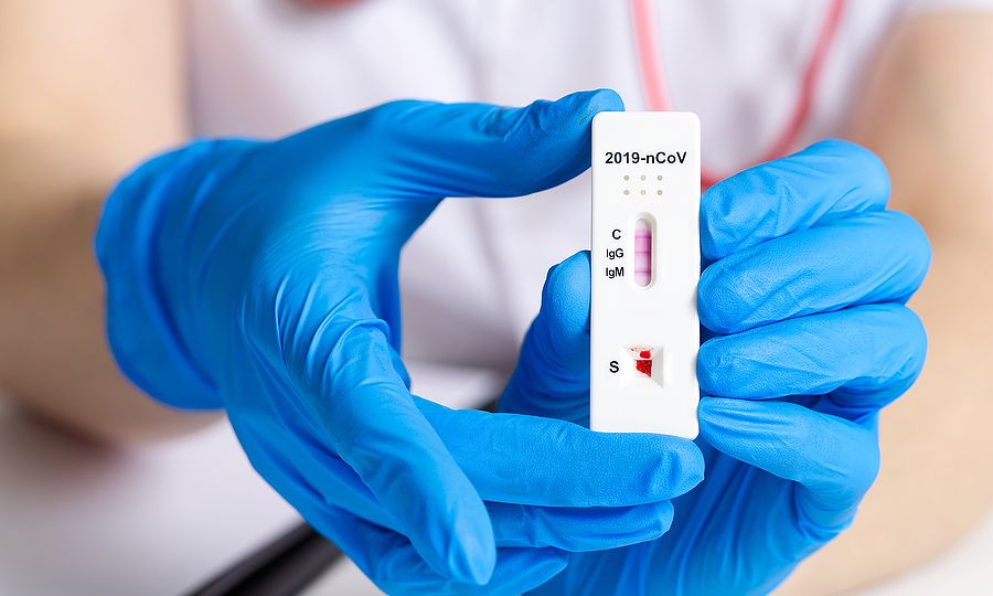 ΕΟΔΥ: Σημεία δωρεάν ελέγxου Covid-19 σήμερα, Δευτέρα 29 Νοεμβρίου
