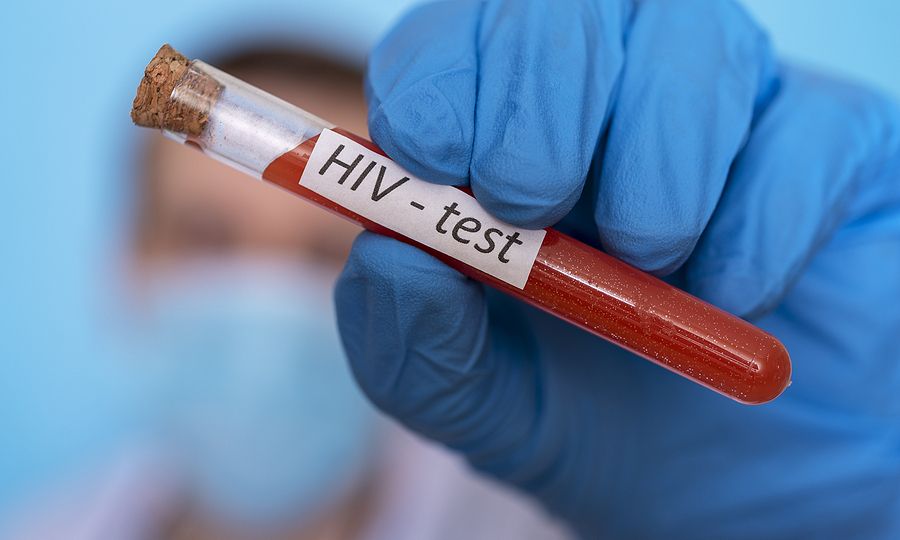 HIV: Μεγαλύτερος ο κίνδυνος καρδιακής ανεπάρκειας για τις γυναίκες και τους νέους