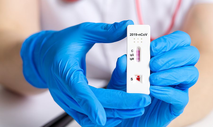 ΕΟΔΥ: Πού γίνονται δωρεάν rapid test για κορονοϊό, σήμερα Τρίτη 18 Ιανουαρίου