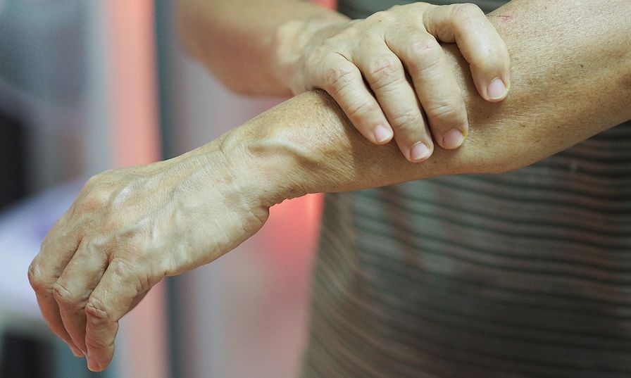 Ποιες είναι οι νευρολογικές επιπλοκές της νόσου COVID-19