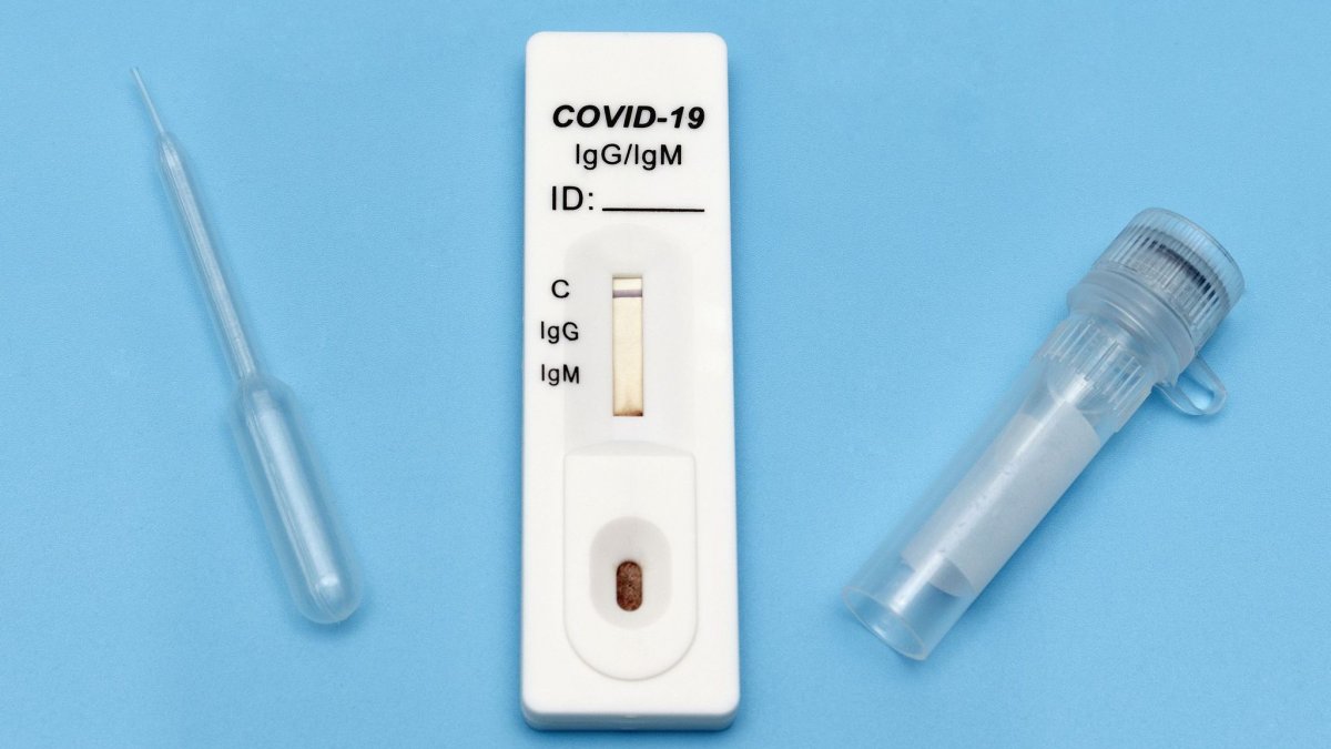 ΕΟΔΥ: Πού γίνονται δωρεάν rapid test για κορονοϊό, σήμερα Παρασκευή 4 Μαρτίου