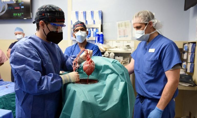 Πέθανε ο πρώτος άνθρωπος με καρδιά γενετικά τροποποιημένου χοίρου
