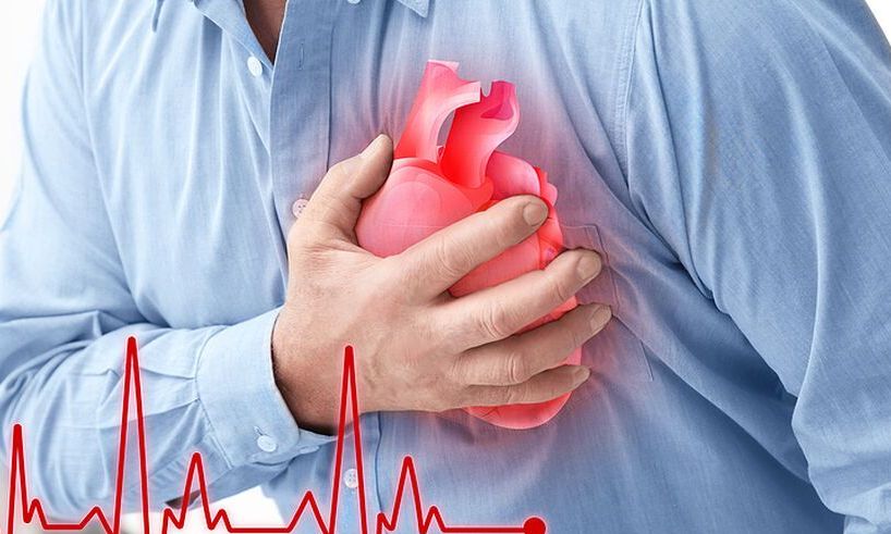 Τα συμπληρώματα ωμέγα-3 συνδέονται με 50% υψηλότερο κίνδυνο κολπικής μαρμαρυγής