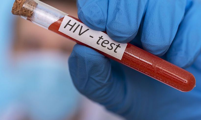 ΣΜΝ: Τα τρία στάδια του HIV και τα συμπτώματα της ιογενούς λοίμωξης
