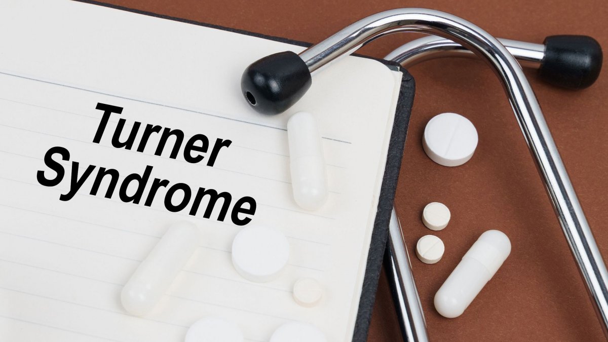 Σύνδρομο Turner: Η γενετική βάση, η διάγνωση και η αντιμετώπισή του