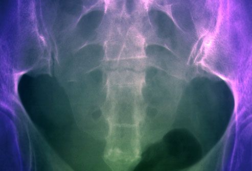 phototake rm photo of pelvis xray