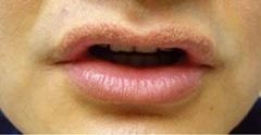 lip1