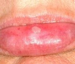lip2