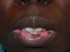 lip3
