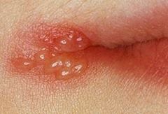 lip4