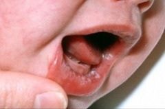 lip6