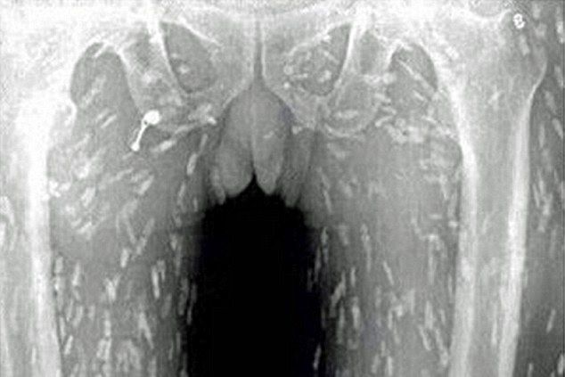 tapeworm2
