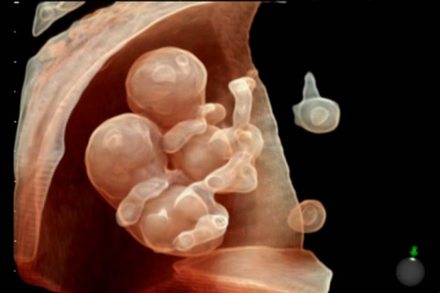 4embryo