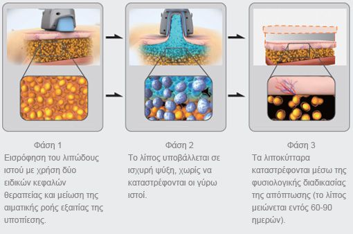 cryo35Faseis