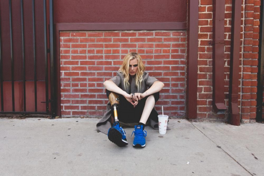 meet the model who lost her leg to toxic shock syndrome 611 body image 1434039881