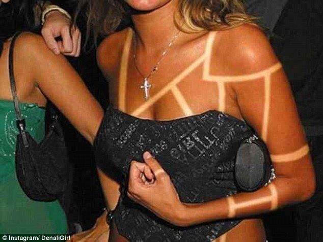 sunburn art 2