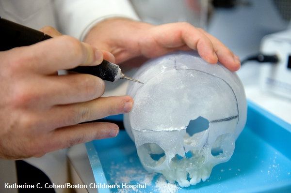 3d printed skull