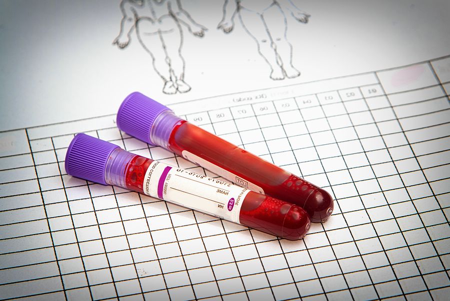 bigstock Blood Vial With Blood Sample O 97158083