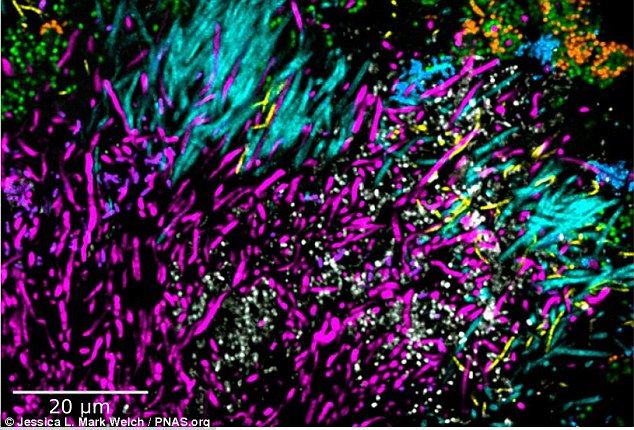 30A3D05000000578 3419753 Localization of Actinomyces within hedgehogs in patches within t a 102 1453927498110