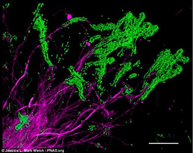 30A3D06300000578 3419753 Corncob structures formed by Corynebacterium and cocci in plaque a 106 1453927498160