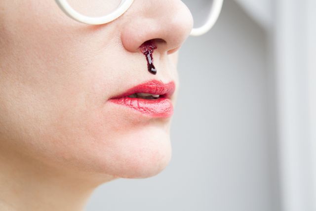 bigstock Closeup Of Woman With Noseblee 105907304
